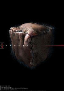 童殤：關愛他的童年--沙包