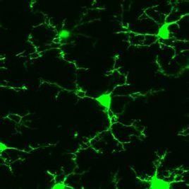 小膠質細胞 小膠質細胞