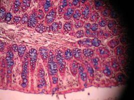 革蘭染色法 革蘭染色法