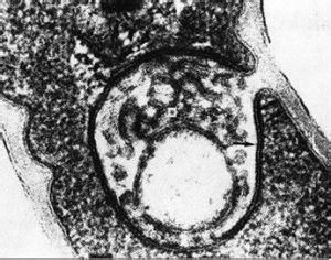 吸精白類 吸精白類