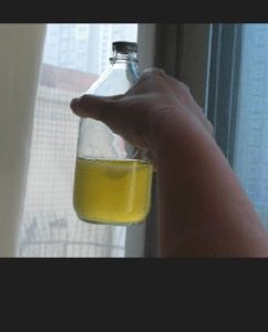 小便渾濁 小便渾濁