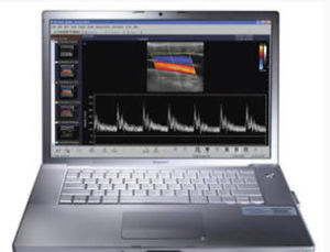 心血管加強版彩超