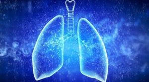 重症急性呼吸綜合徵