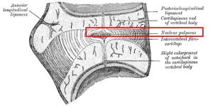 nucleus pulposus
