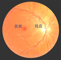 （圖）視網膜