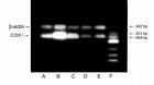 （圖）mRNA PCR擴增產物電泳結果