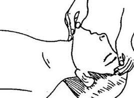 頸動脈搏動減弱或消失 頸動脈搏動減弱或消失