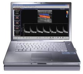 攜帶型彩超 攜帶型彩超