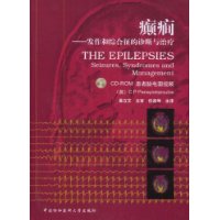 癲癎:發作和綜合徵的診斷與治療