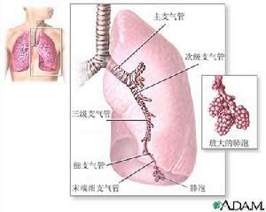 煤塵肺