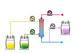 血液透析濾過 血液透析濾過