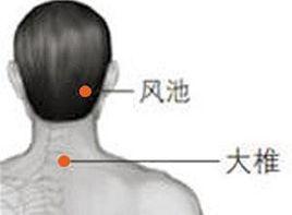 頸根部斜方肌及風池穴處有壓痛點 頸根部斜方肌及風池穴處有壓痛點
