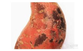 黑斑病紅薯中毒 黑斑病紅薯中毒