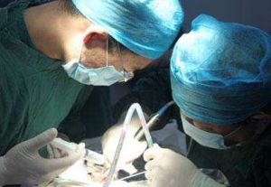 美國篩前神經阻斷術 美國篩前神經阻斷術