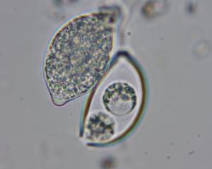 （圖）語言基因