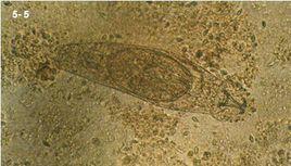 三代蟲病 三代蟲病