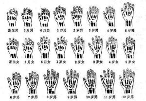 兒童正常骨齡示意圖