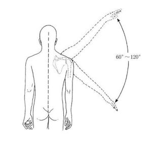 肩關節外展活動時疼痛弧