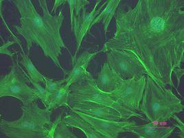 骨原細胞 骨原細胞