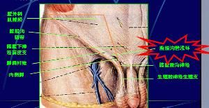 腹股溝管淺環 腹股溝管淺環
