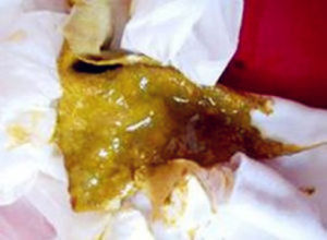 糞便量少 糞便量少