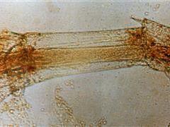 對蝦腸道細菌病 對蝦腸道細菌病