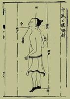 《楊敬齋針灸全書》 《楊敬齋針灸全書》