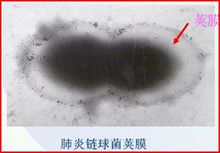肺炎鏈球菌莢膜圖片