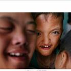 化學戰受害者紀念日----化學武器帶來的災難