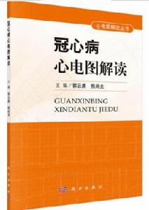 冠心病心電圖解讀 冠心病心電圖解讀