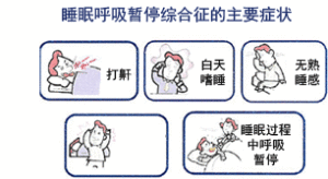 睡眠呼吸暫停綜合徵臨床表現