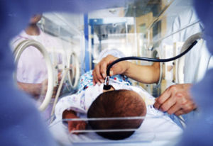 新生兒膽紅素腦病