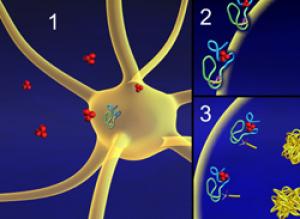 阿爾茨海默病性痴呆