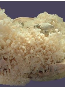 惡性葡萄胎 惡性葡萄胎