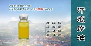 汗皰疹油 汗皰疹油