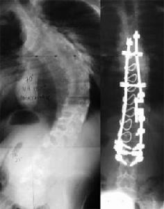 舉例:直在其中矣