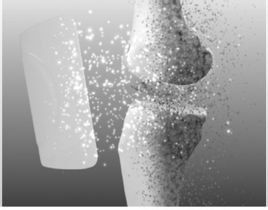 風濕骨病 風濕骨病