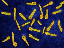 破傷風桿菌 破傷風桿菌