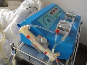 腹水超濾回輸技術 腹水超濾回輸技術