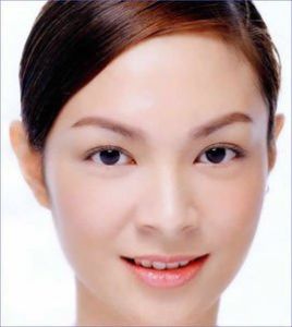 額部除皺術 額部除皺術