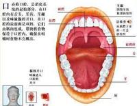 口腔潰瘍解剖圖