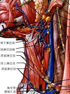 頸部淋巴結轉移癌 頸部淋巴結轉移癌