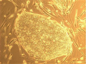 德國科學家利用幹細胞技術成功培育出毛囊