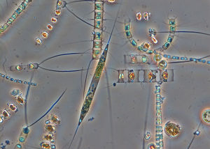 披針曲殼藻 披針曲殼藻