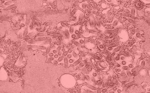 拉沙熱病毒 拉沙熱病毒