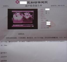 胎芽胎心 胎芽胎心