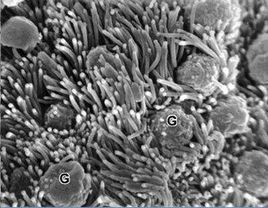 杯狀細胞 杯狀細胞