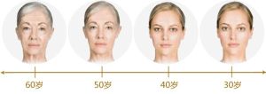 皮膚年齡