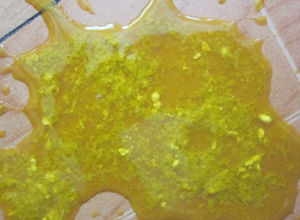 輪狀病毒感染腹瀉 輪狀病毒感染腹瀉