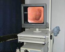 奧林巴斯V-70電子內鏡系統 奧林巴斯V-70電子內鏡系統